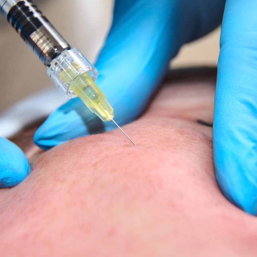 VTCT Level 7 aesthetics training in Orpington, Kent