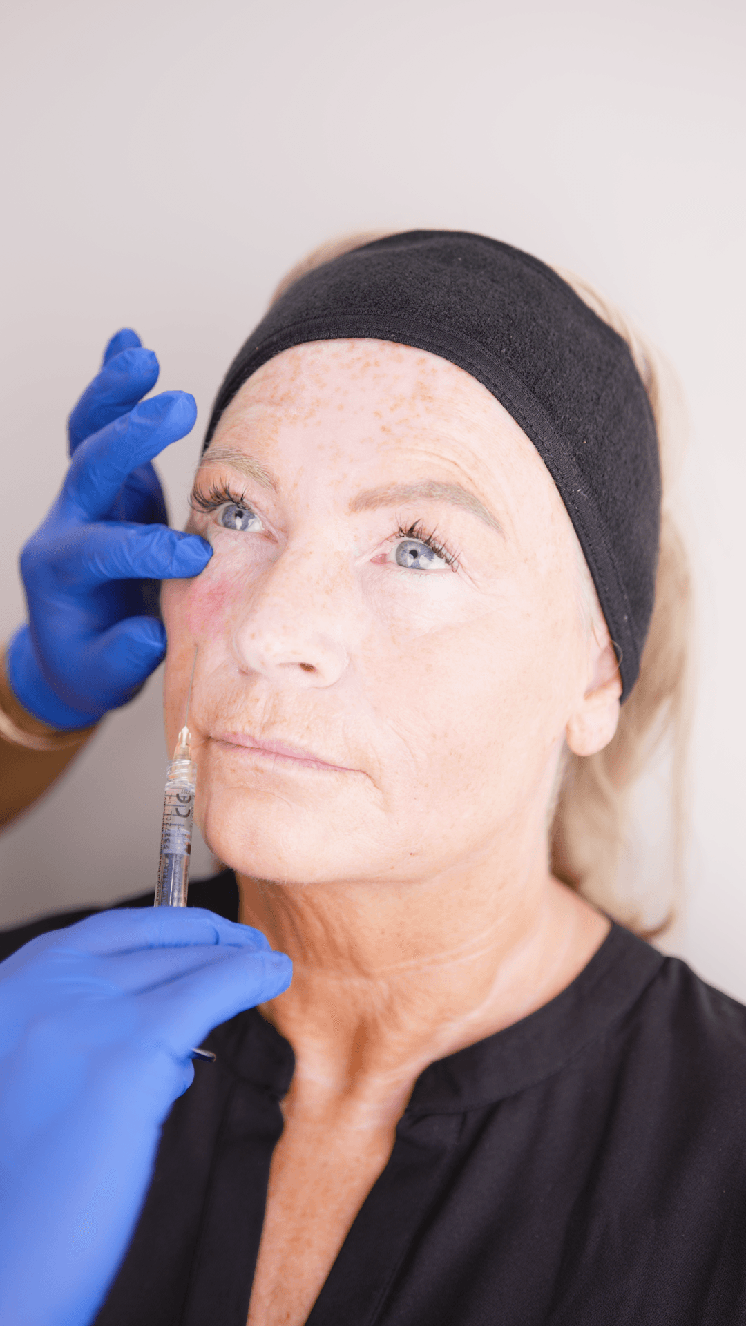 Rejuvenation treatment at Charmelle Injects