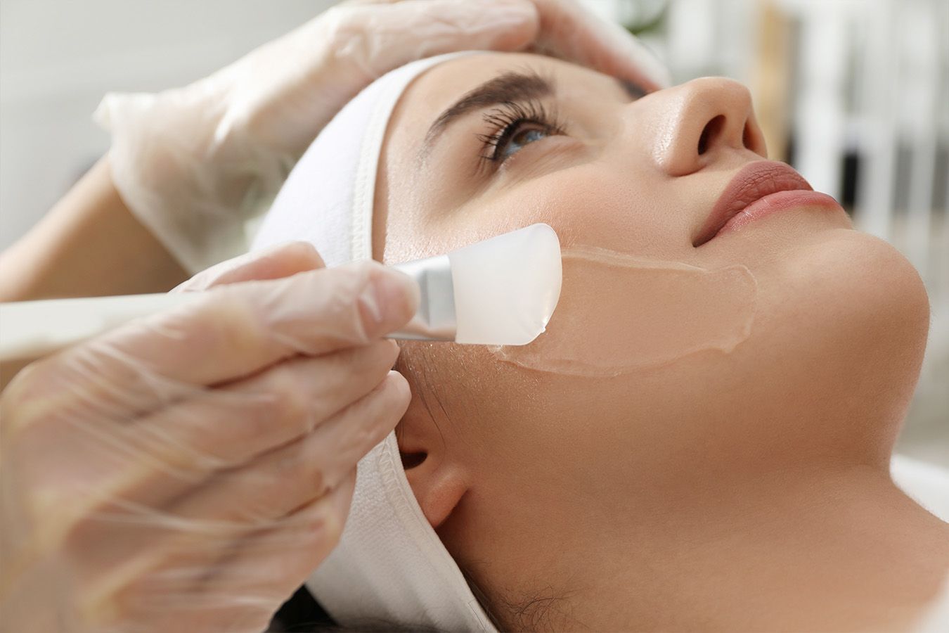 Chemical Skin Peels | Advanced Skin Rejuvenation at Charmelle Injects